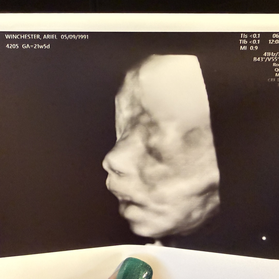 Photo shared by Ariel for their Babylist baby registry.