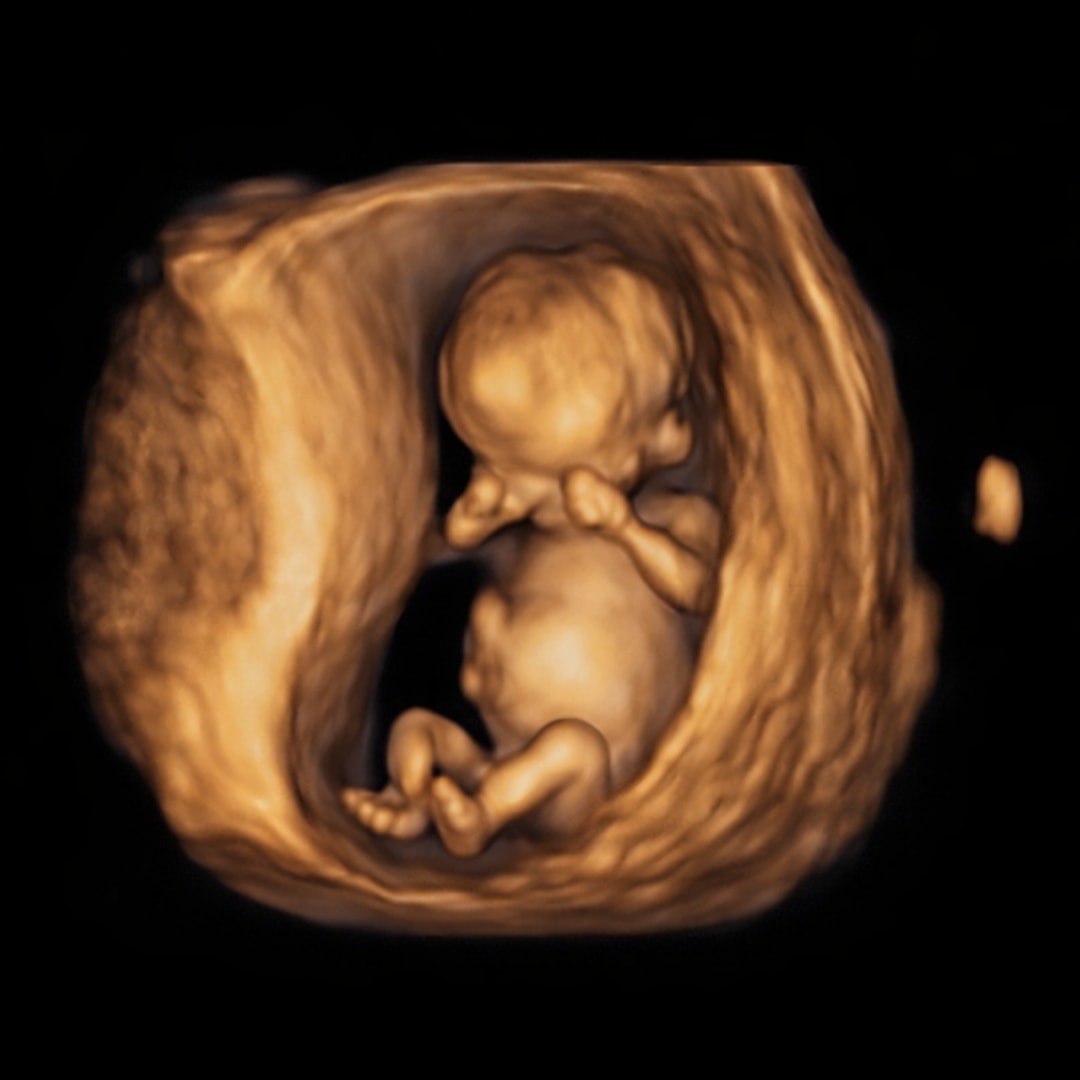 Photo shared by Jacie for their Babylist baby registry.