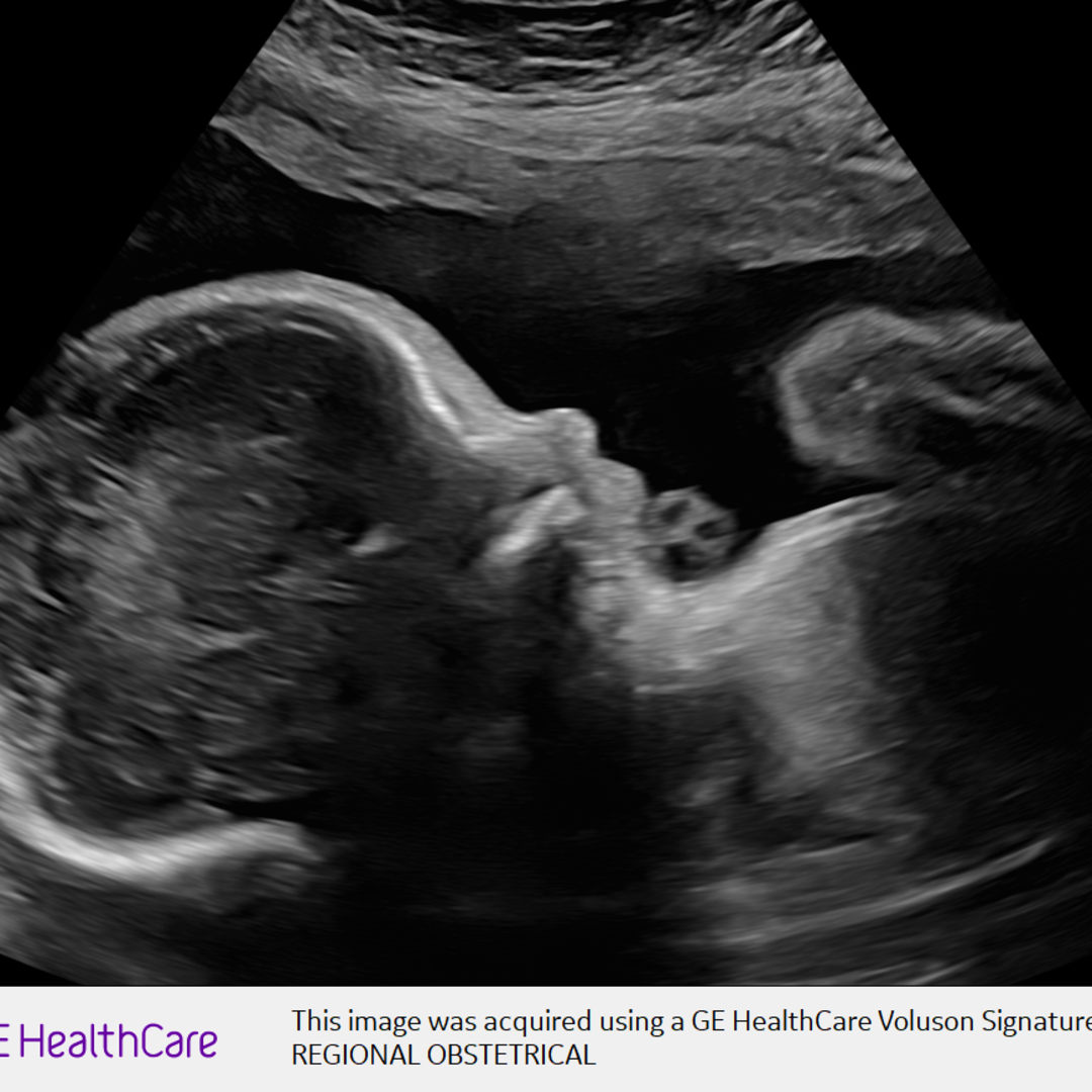 Photo shared by Lindsey for their Babylist baby registry.