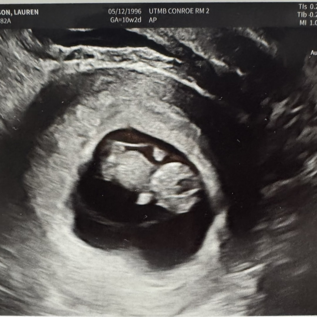 Photo shared by Sterling for their Babylist baby registry.