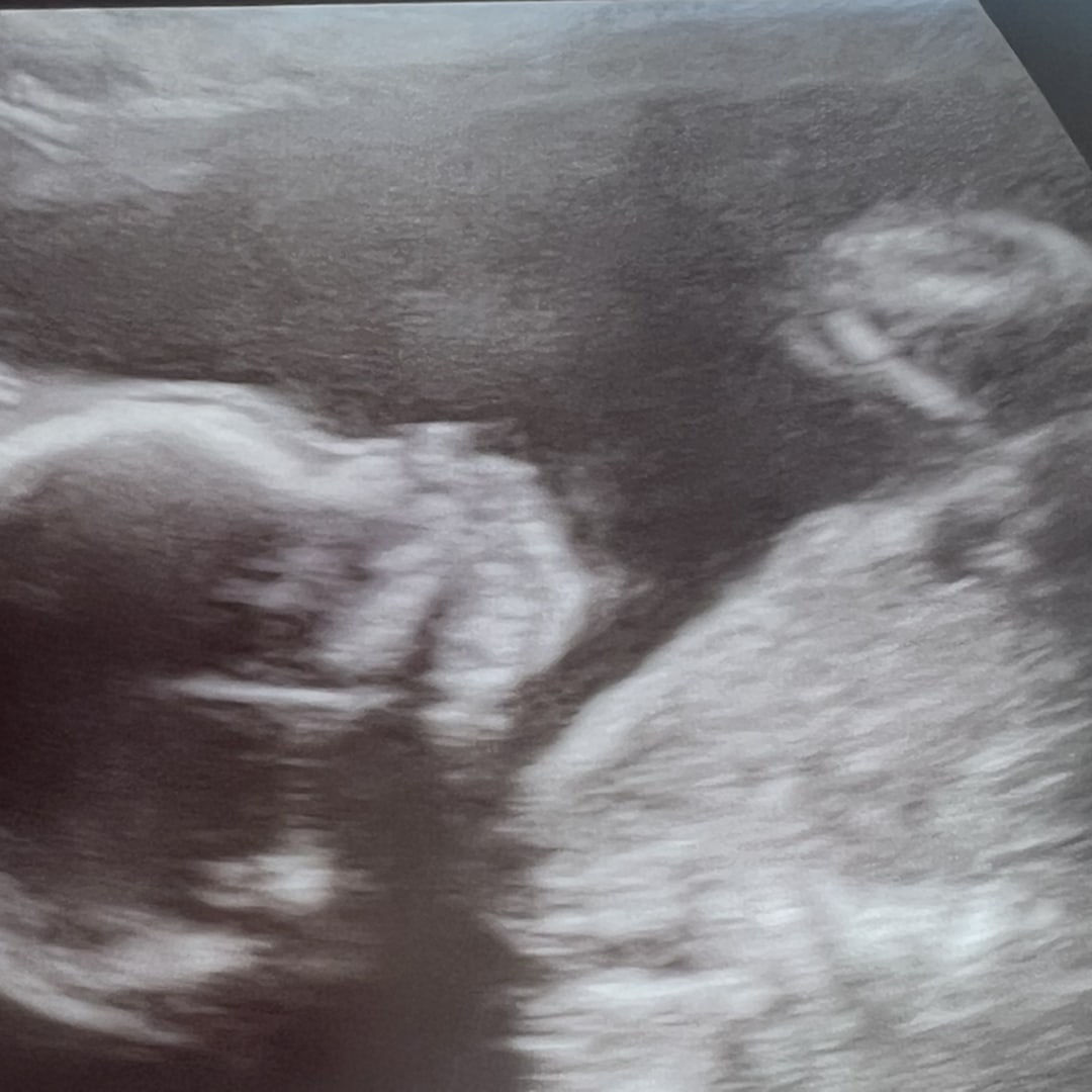 Photo shared by Ariz for their Babylist baby registry.