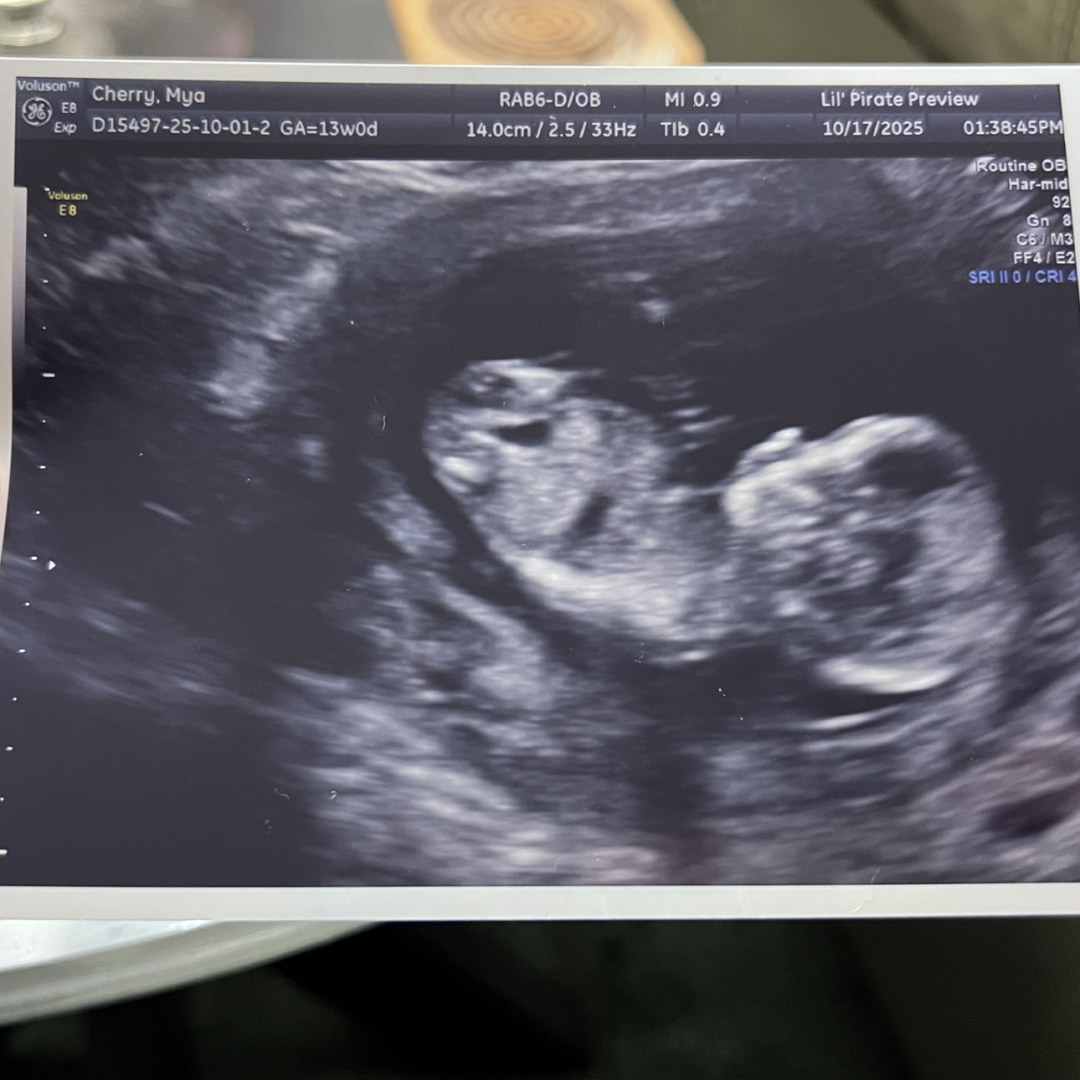 Photo shared by Mya for their Babylist baby registry.