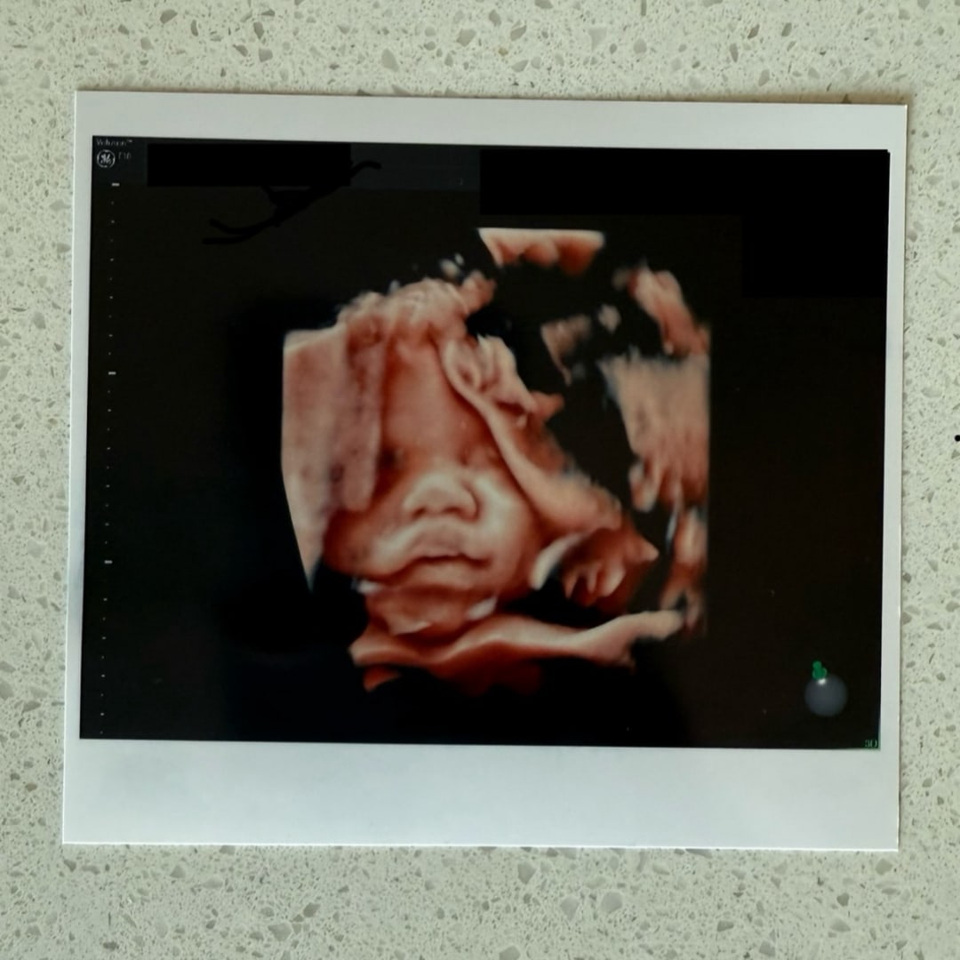 Photo shared by Arielle for their Babylist baby registry.