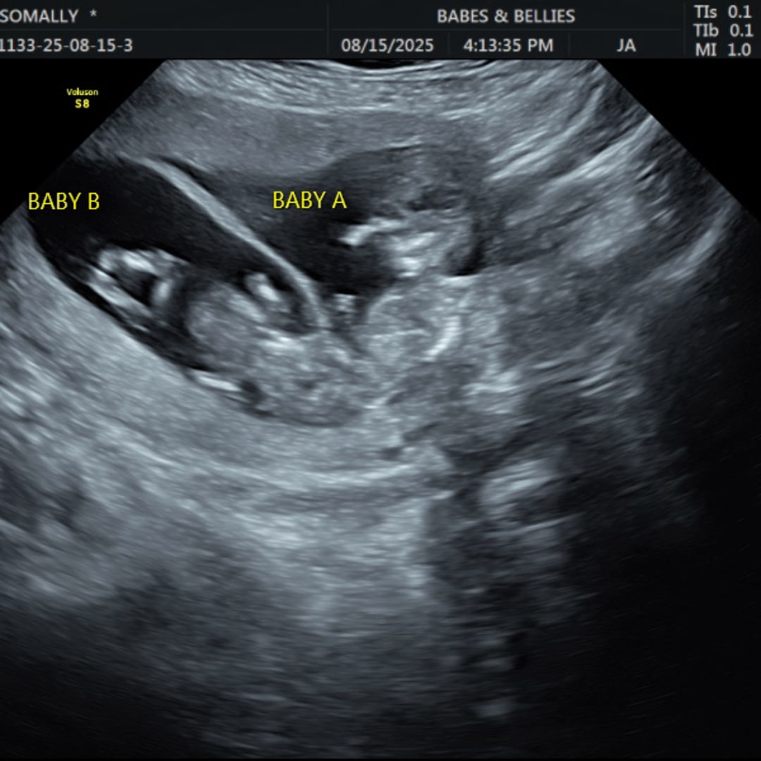Photo shared by Molly for their Babylist baby registry.