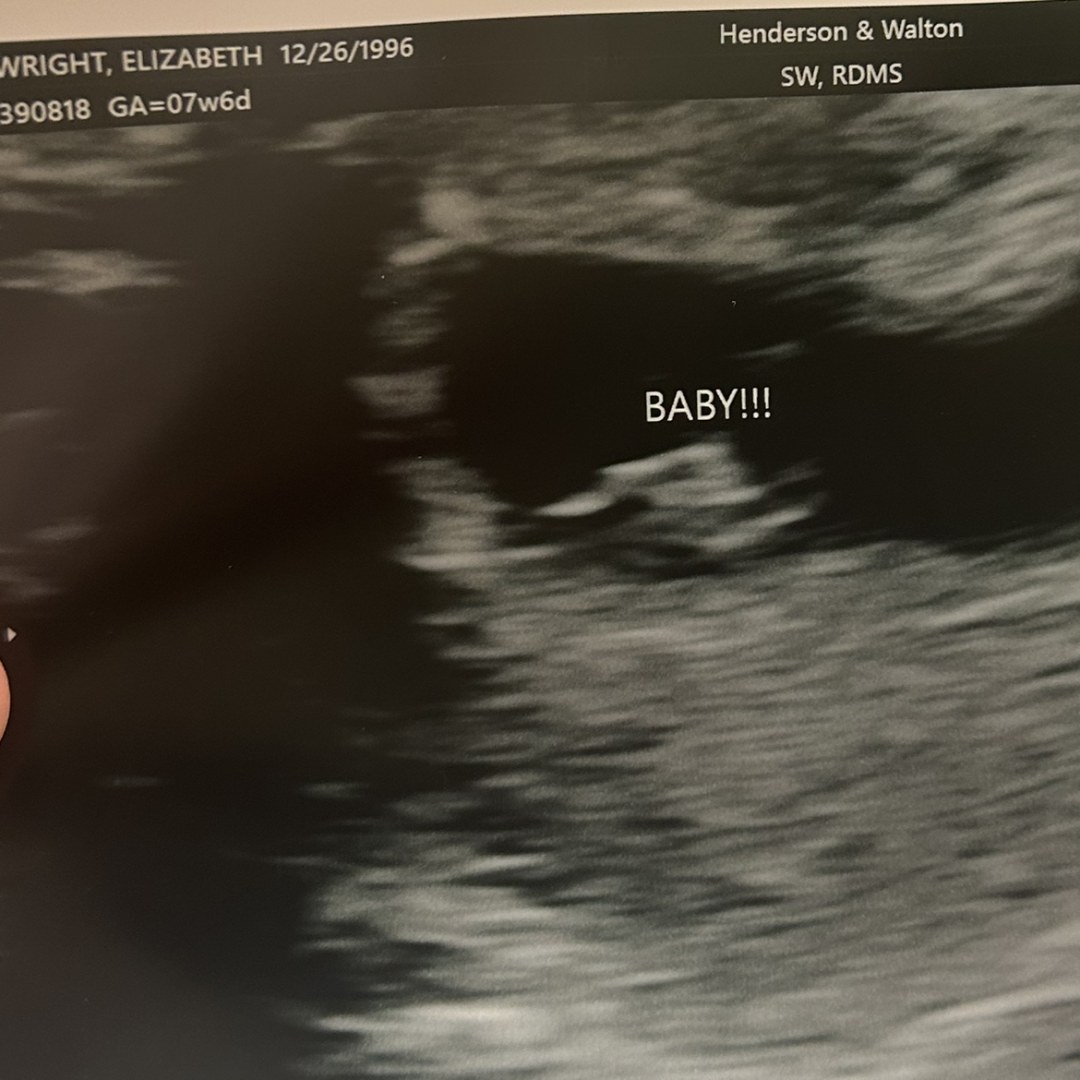 Photo shared by Elizabeth for their Babylist baby registry.