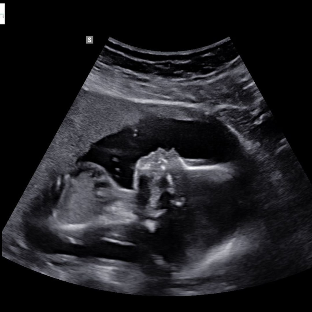 Photo shared by Kate & Eric for their Babylist baby registry.