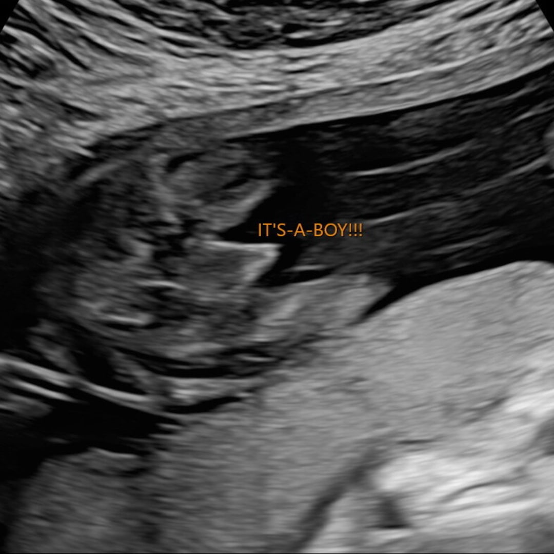 Photo shared by Kyla for their Babylist baby registry.