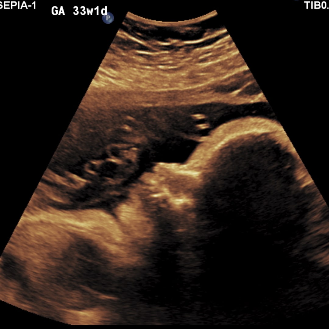 Photo shared by Hayden for their Babylist baby registry.