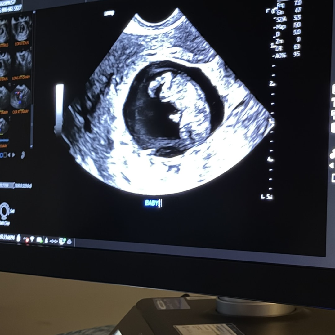 Photo shared by Karina for their Babylist baby registry.
