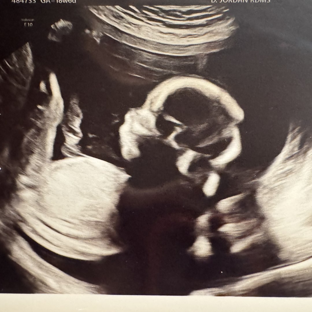 Photo shared by Gwen for their Babylist baby registry.