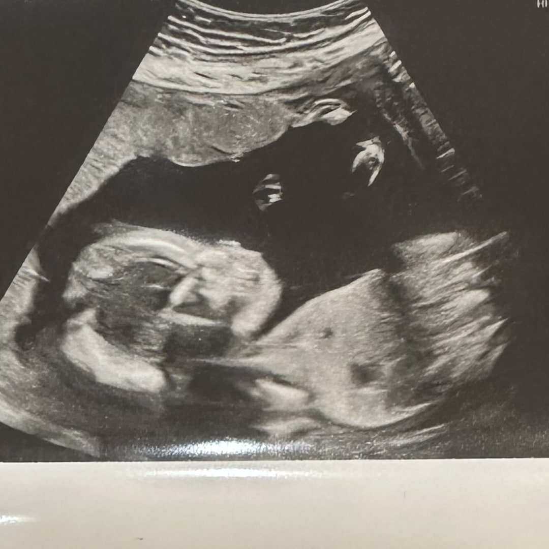 Photo shared by Kelly for their Babylist baby registry.