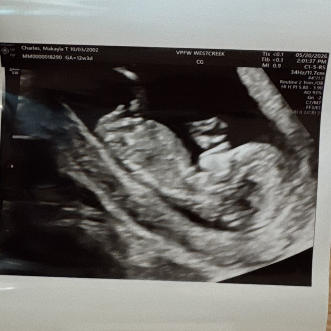 Photo shared by MaKayla for their Babylist baby registry.