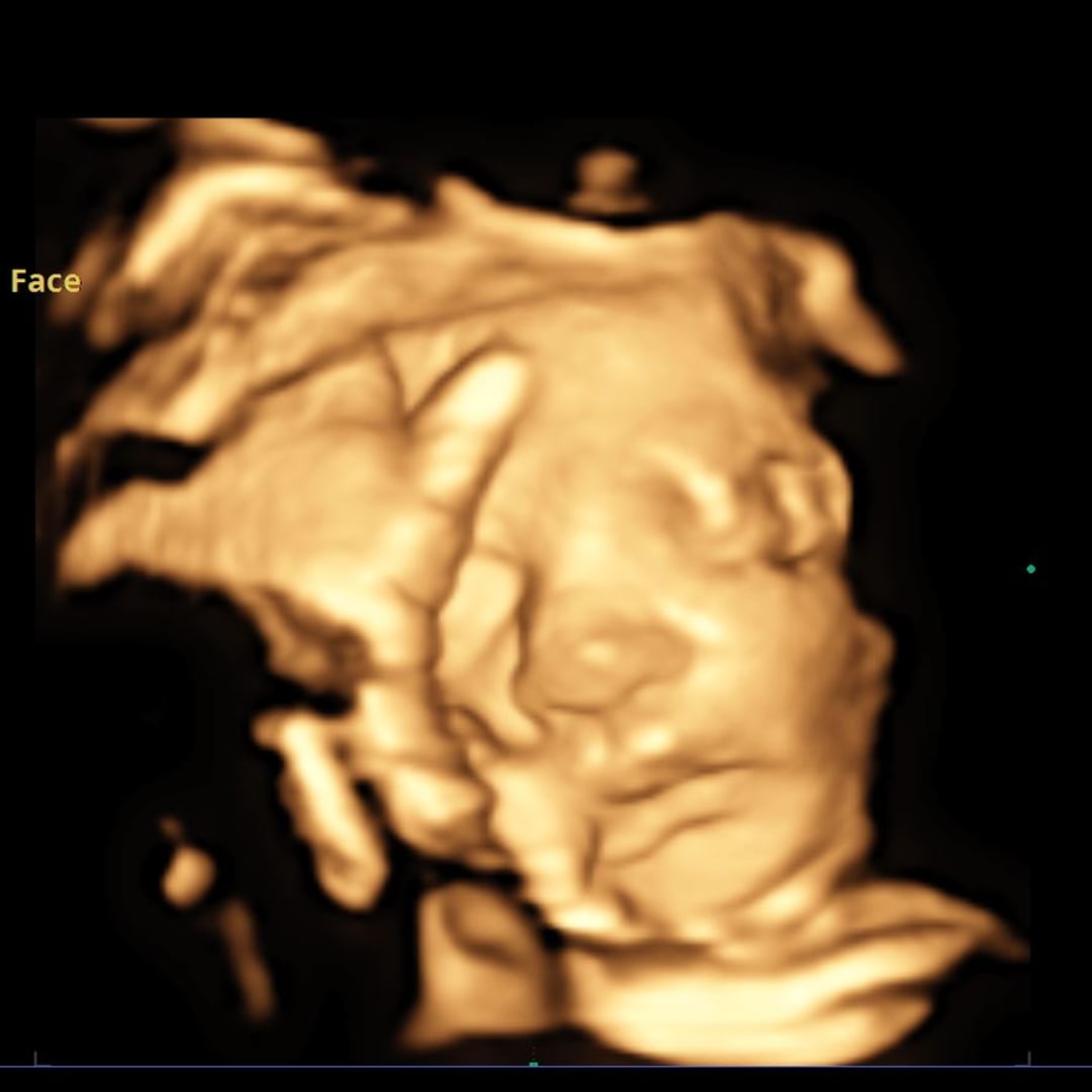 Photo shared by Marlene for their Babylist baby registry.