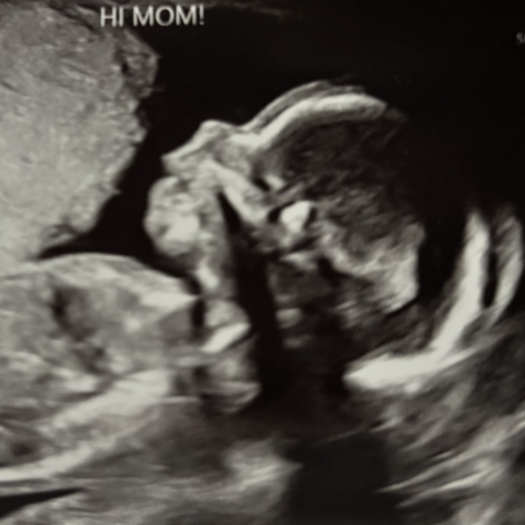 Photo shared by Kartier for their Babylist baby registry.