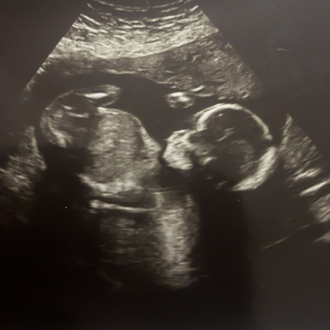 Photo shared by Aliah for their Babylist baby registry.