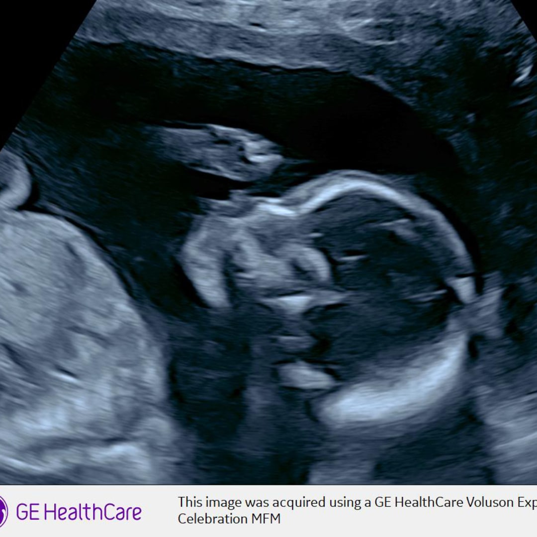 Photo shared by Angy for their Babylist baby registry.