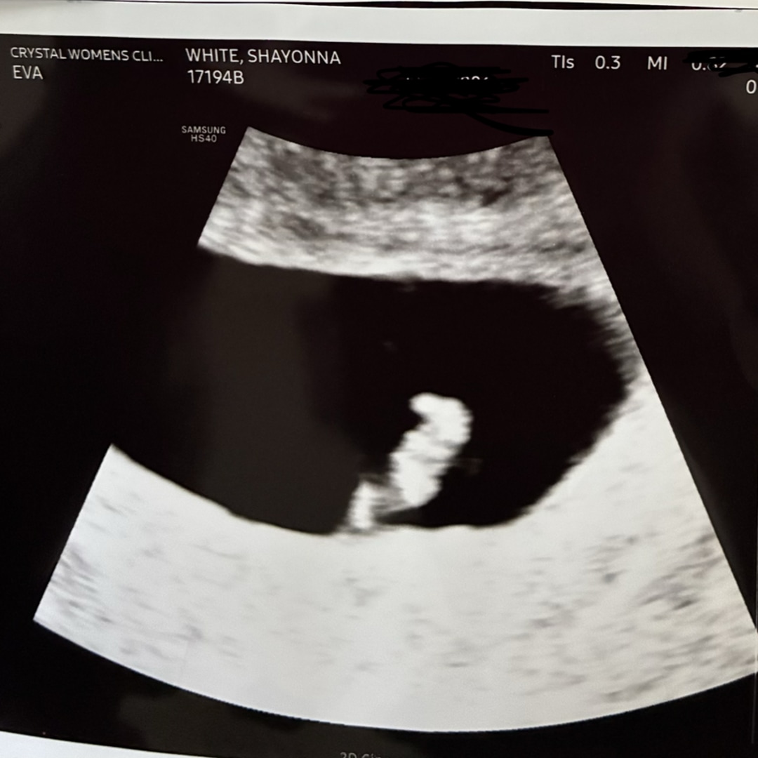 Photo shared by Shayonna for their Babylist baby registry.