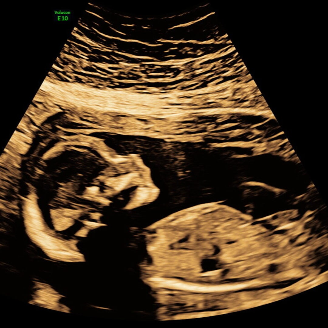 Photo shared by Riley for their Babylist baby registry.