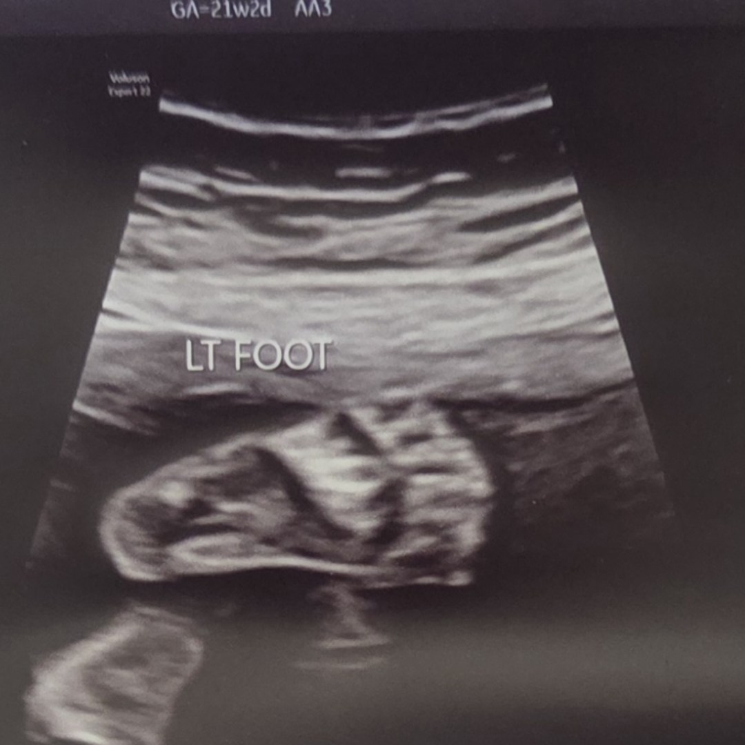 Photo shared by Diana for their Babylist baby registry.