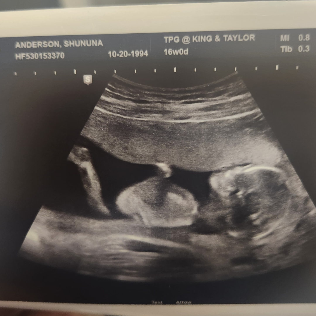 Photo shared by Shununa for their Babylist baby registry.