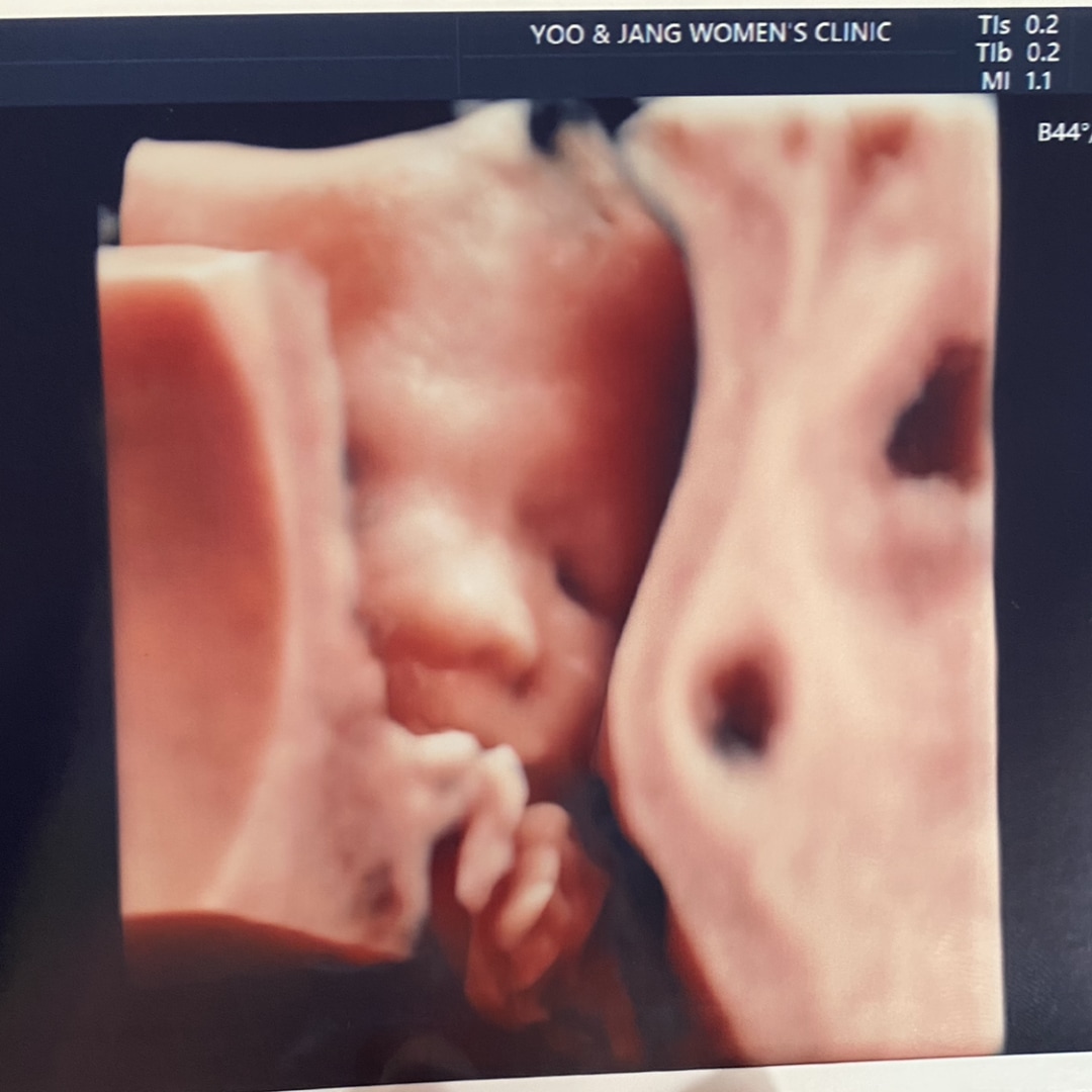 Photo shared by Minhee for their Babylist baby registry.