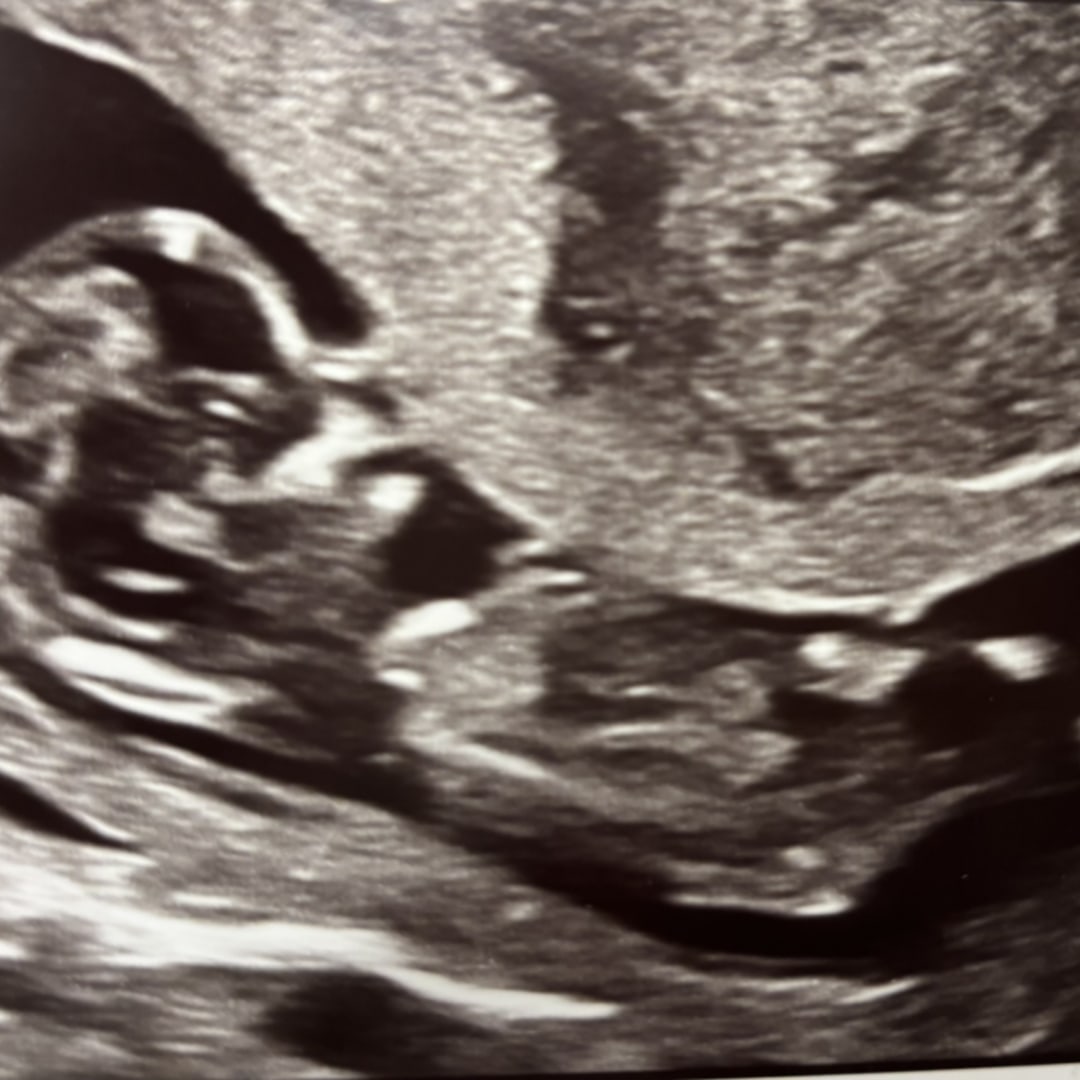 Photo shared by Josie for their Babylist baby registry.