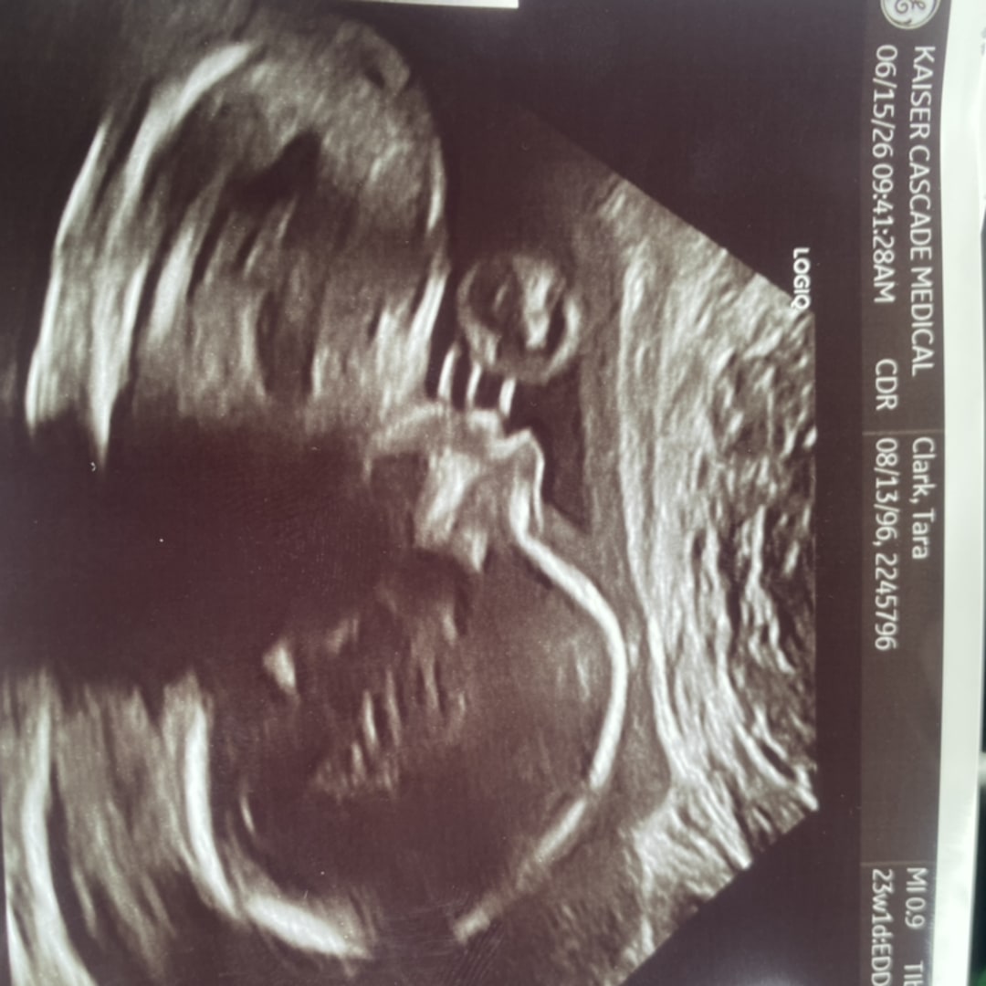 Photo shared by Tara for their Babylist baby registry.