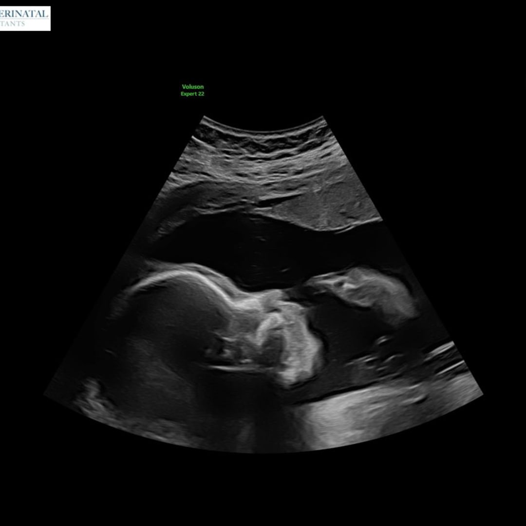 Photo shared by Maria for their Babylist baby registry.