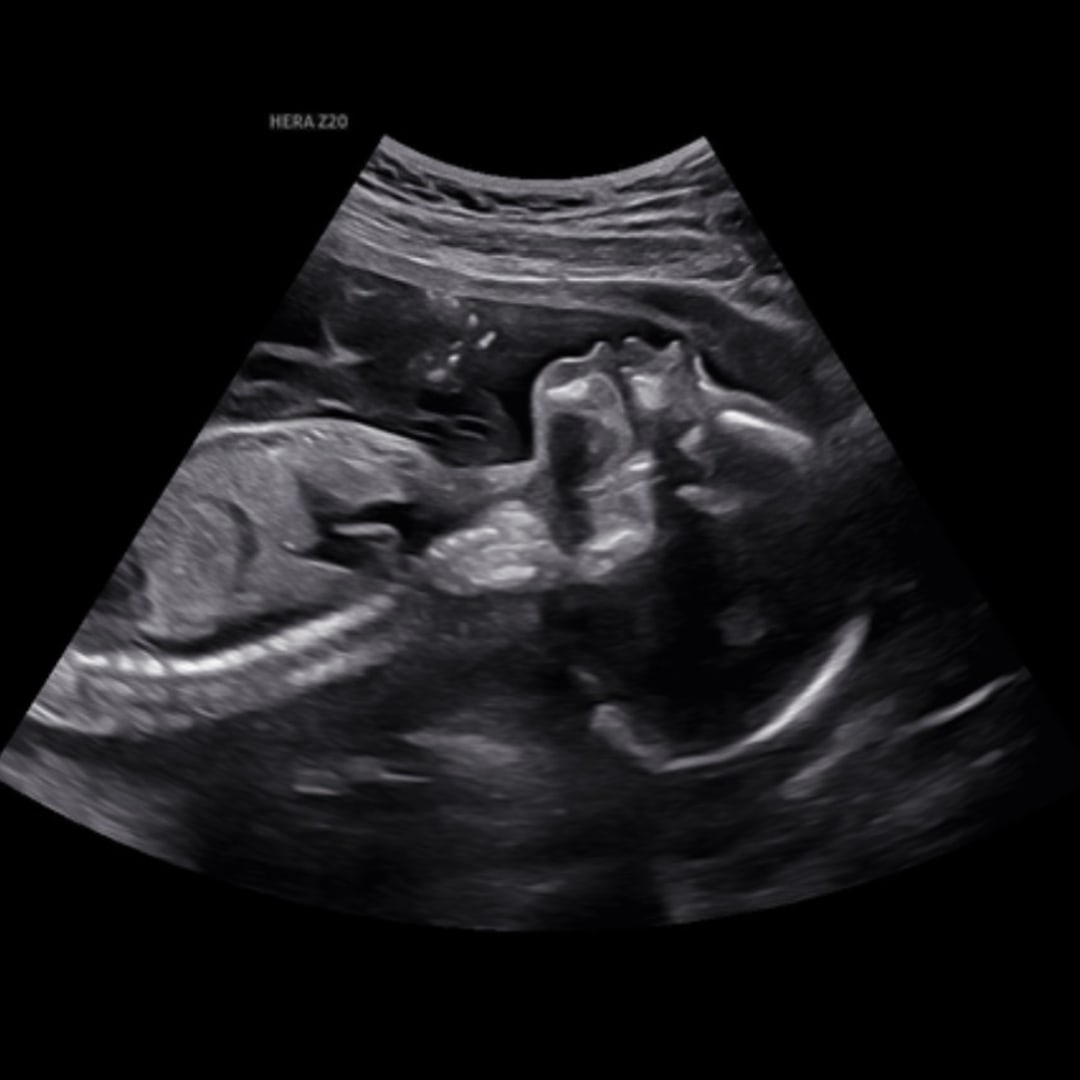 Photo shared by Donata for their Babylist baby registry.