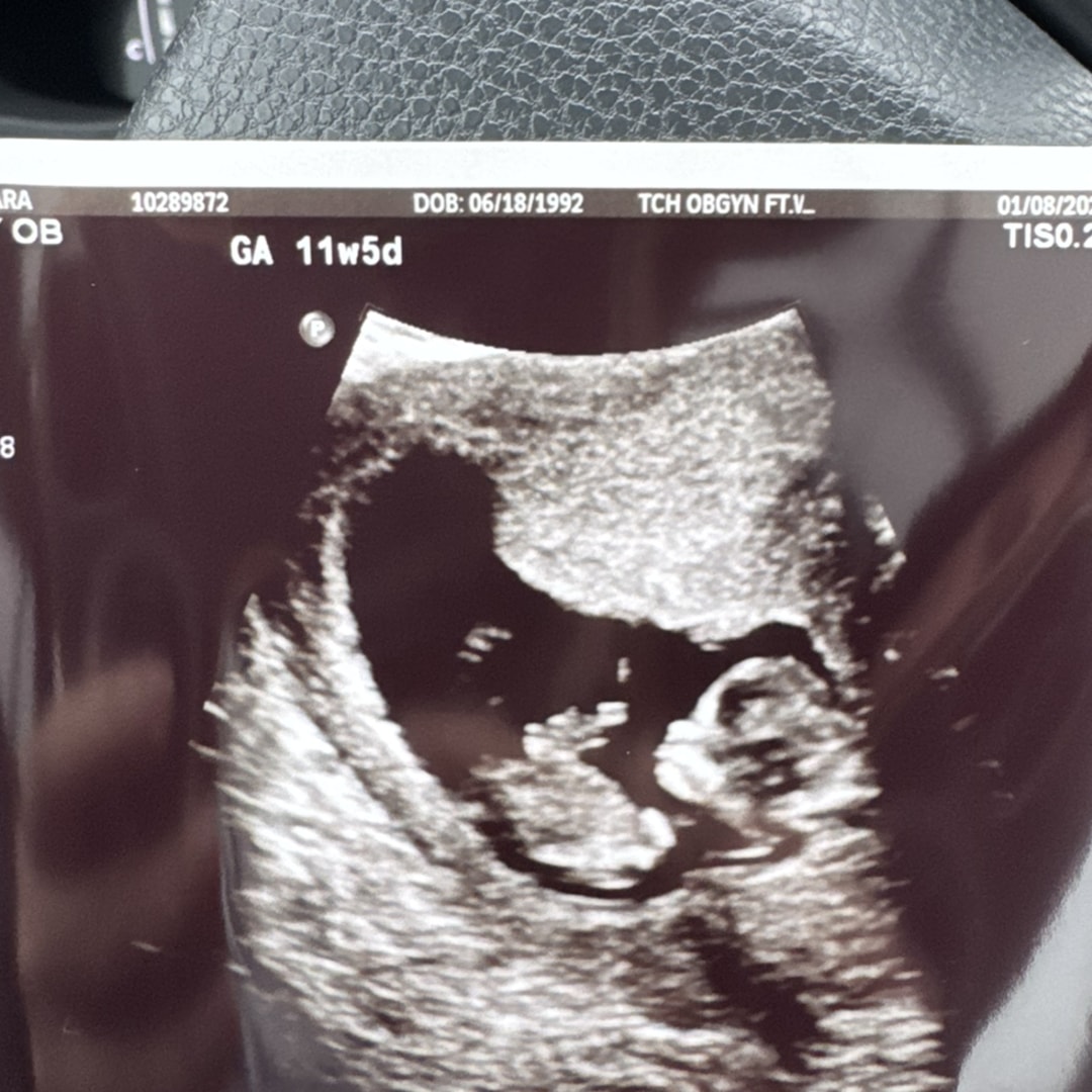 Photo shared by Sara for their Babylist baby registry.