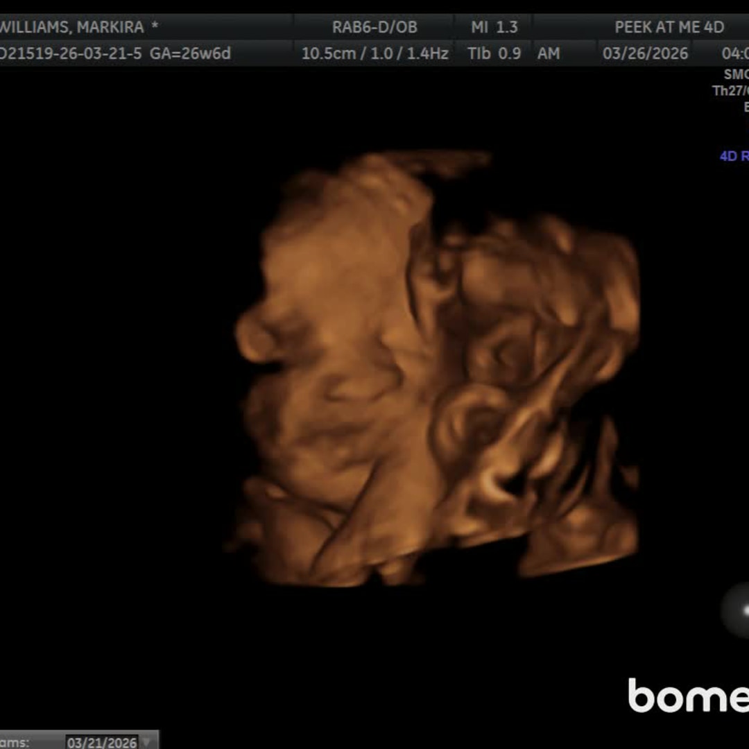 Photo shared by Markira for their Babylist baby registry.