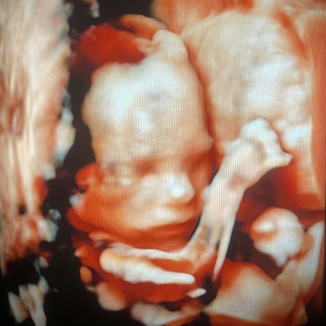 Photo shared by Jen for their Babylist baby registry.