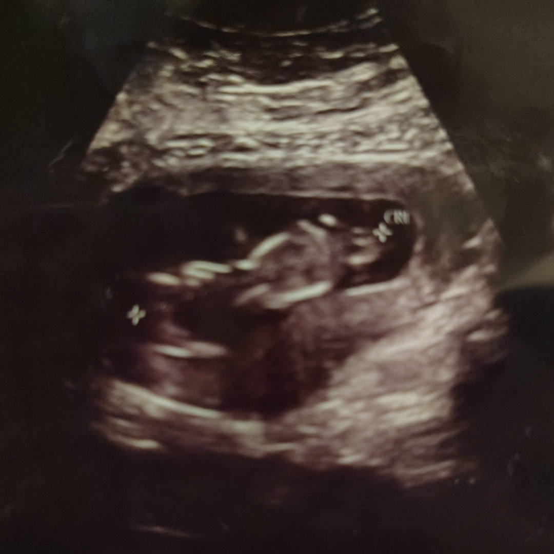 Photo shared by Haley for their Babylist baby registry.