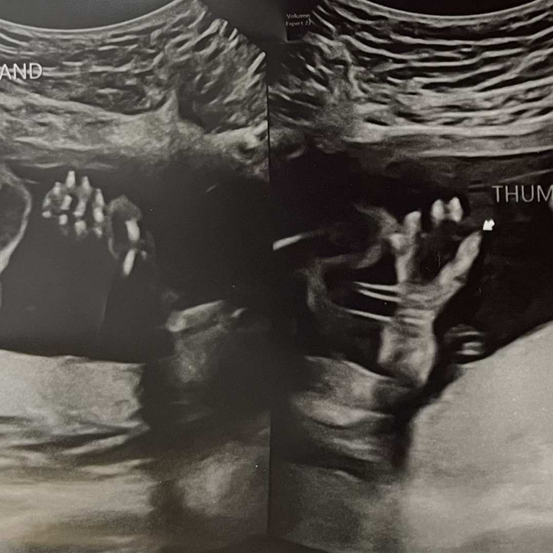 Photo shared by Abbey for their Babylist baby registry.