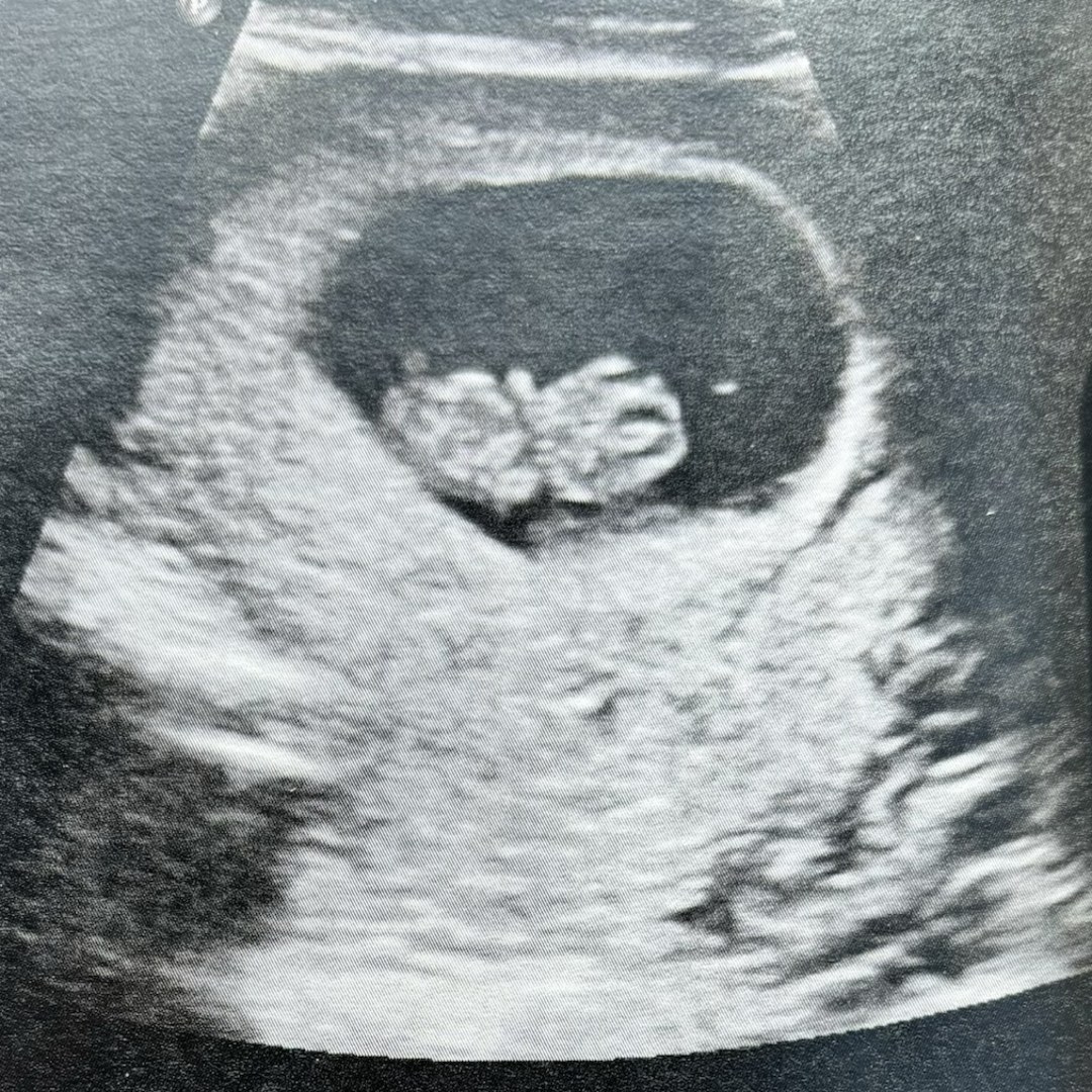 Photo shared by Destiny for their Babylist baby registry.