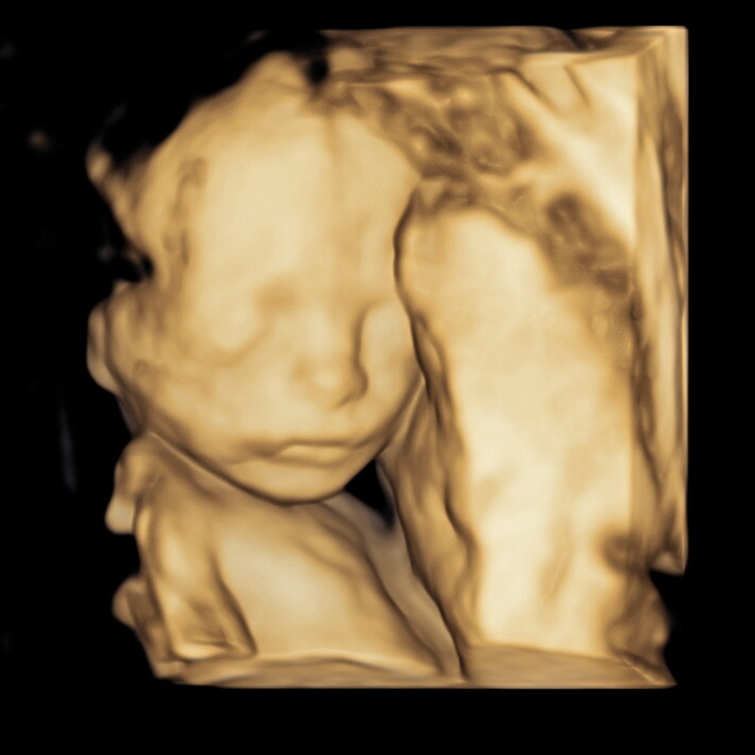 Photo shared by Izajah for their Babylist baby registry.
