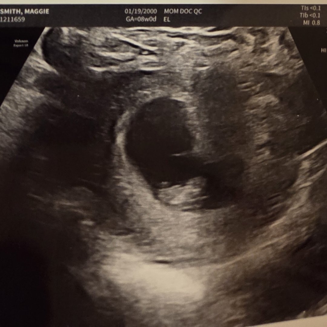 Photo shared by Maggie for their Babylist baby registry.