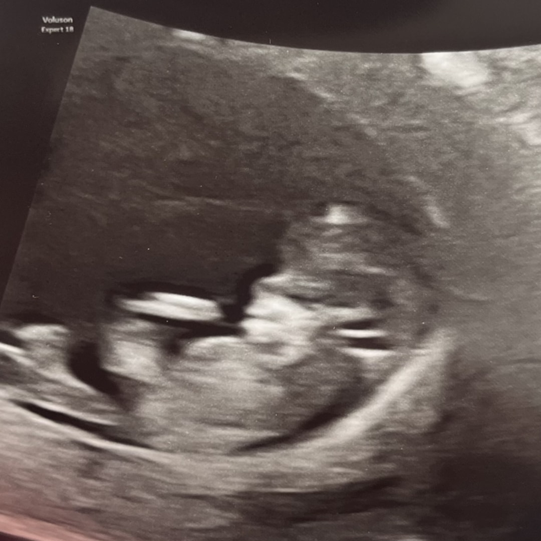 Photo shared by Abby for their Babylist baby registry.