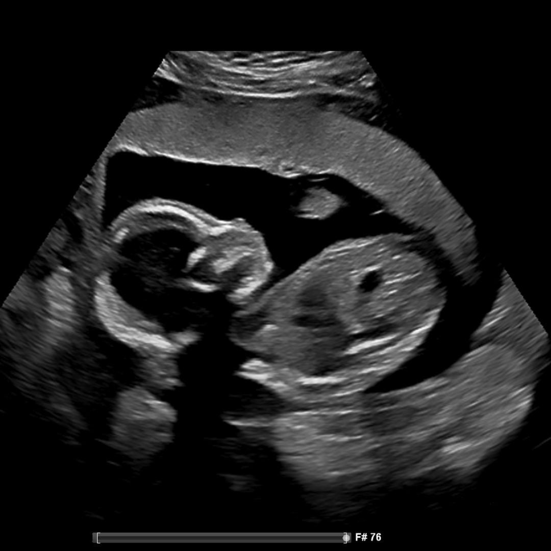 Photo shared by Lexi for their Babylist baby registry.