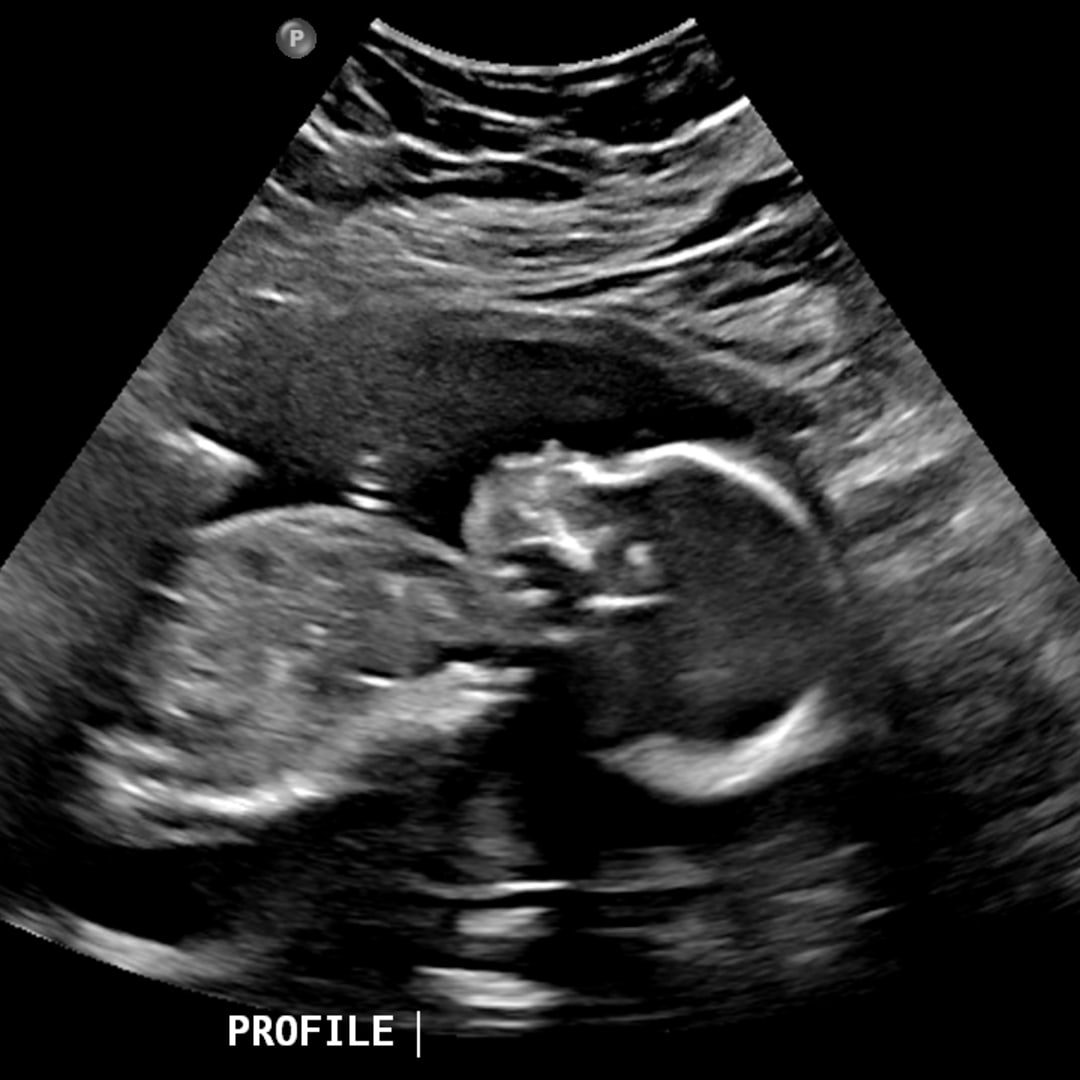 Photo shared by Claira for their Babylist baby registry.