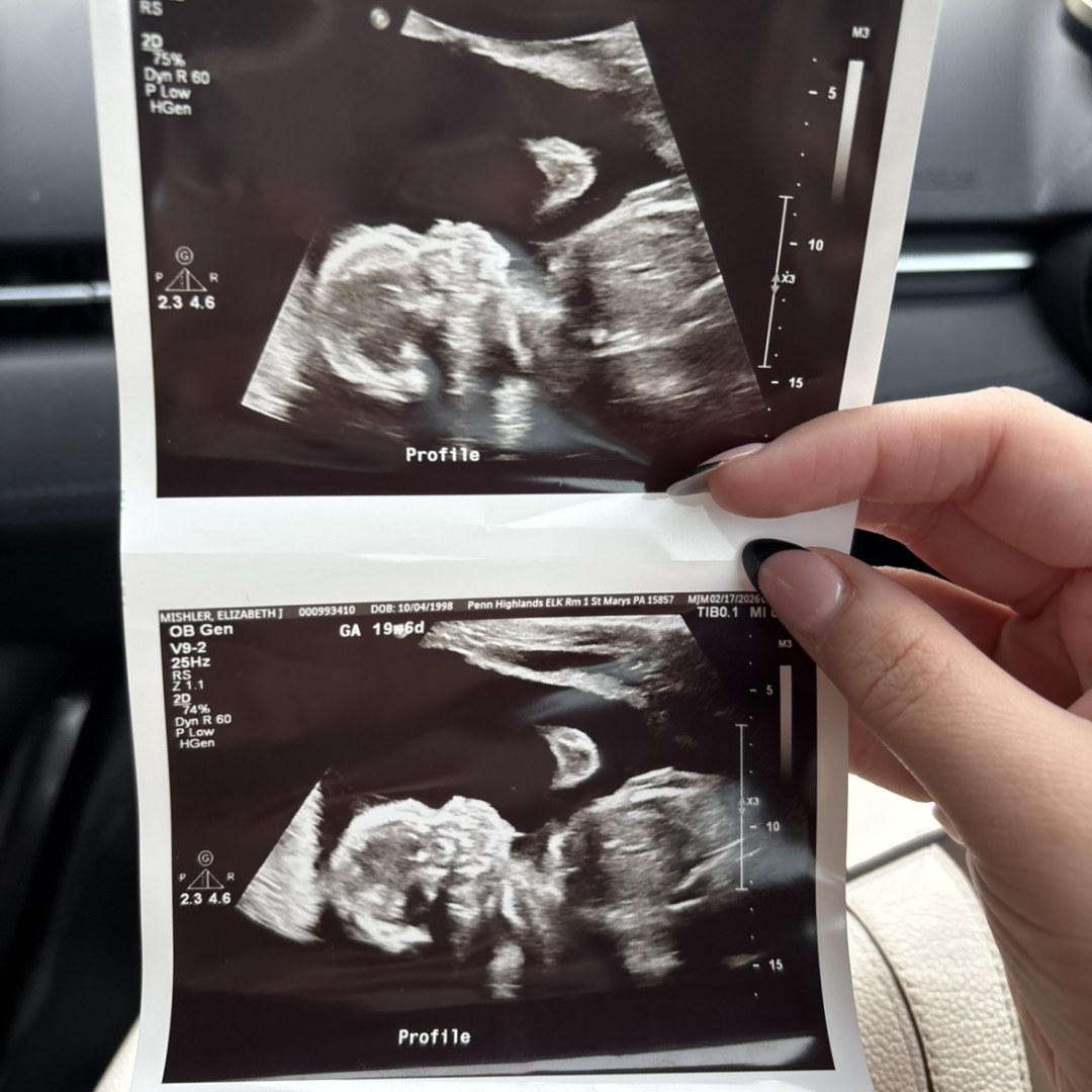 Photo shared by Elizabeth for their Babylist baby registry.