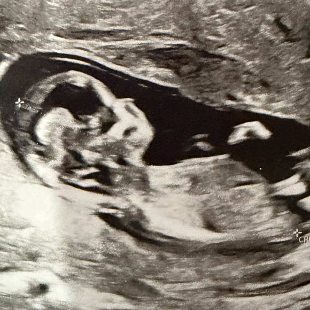 Photo shared by Olivia for their Babylist baby registry.