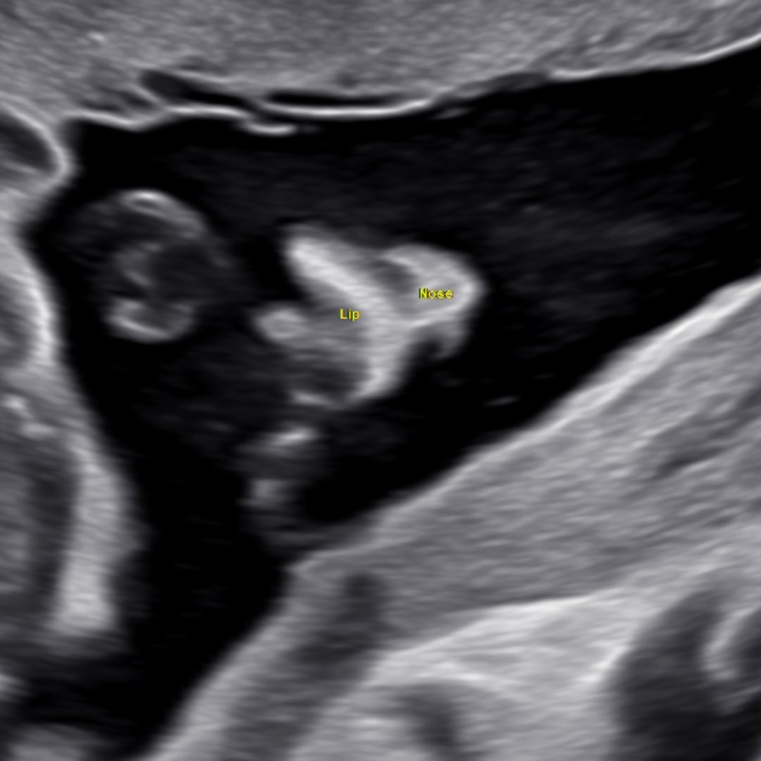 Photo shared by Evelyn for their Babylist baby registry.