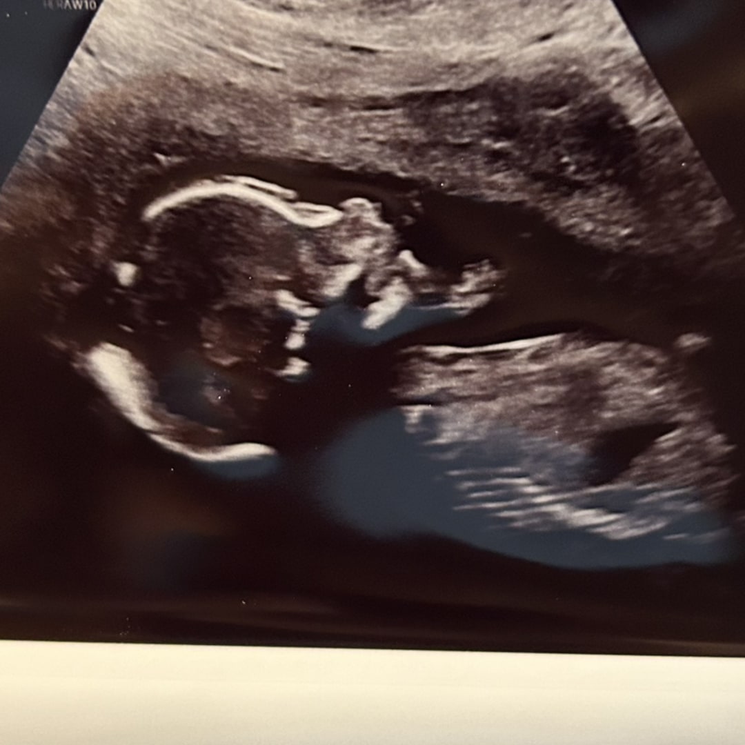 Photo shared by Elizabeth for their Babylist baby registry.