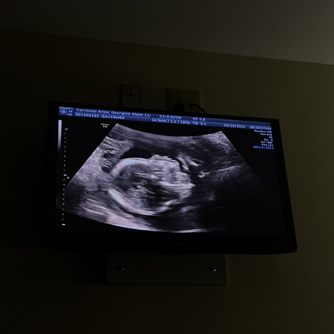 Photo shared by Georgina for their Babylist baby registry.