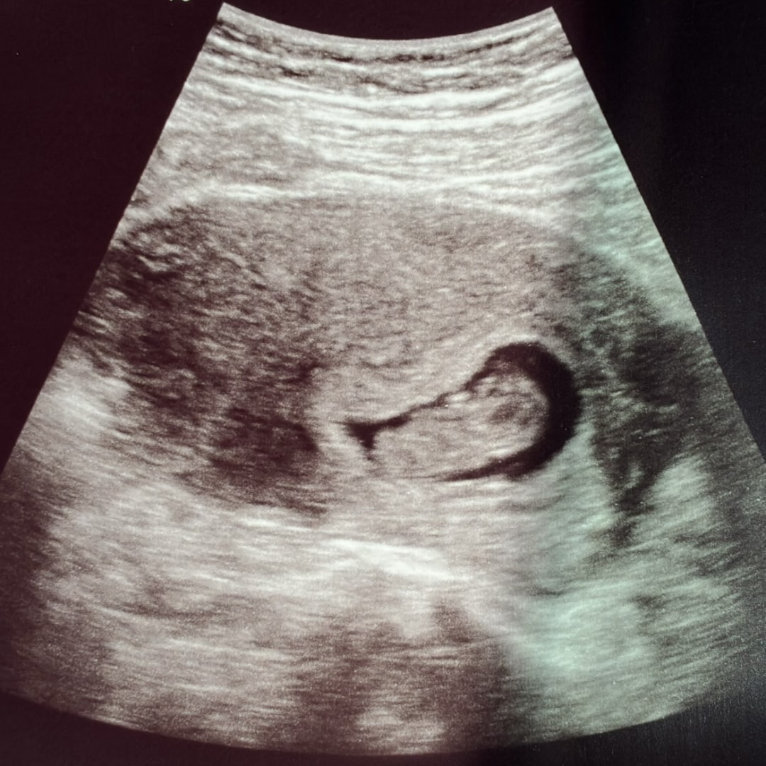 Photo shared by Cristina for their Babylist baby registry.