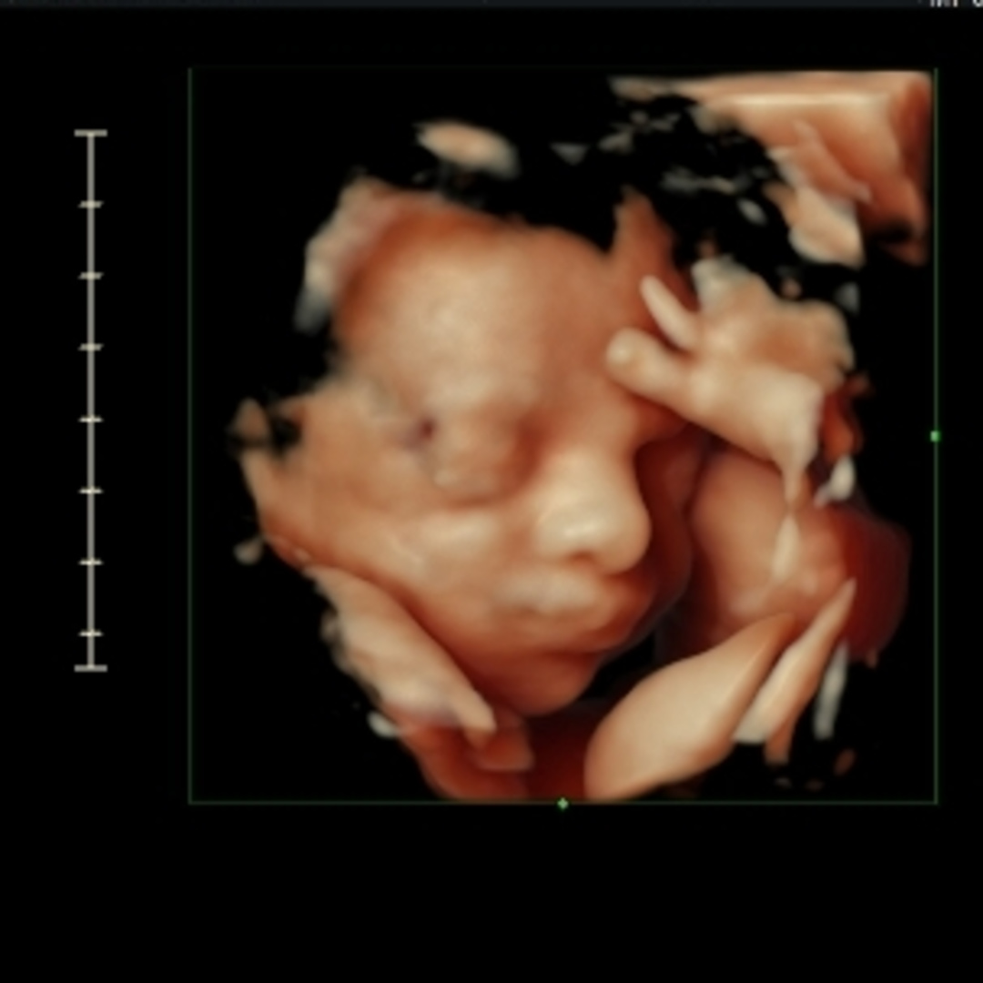 Photo shared by Sarah for their Babylist baby registry.