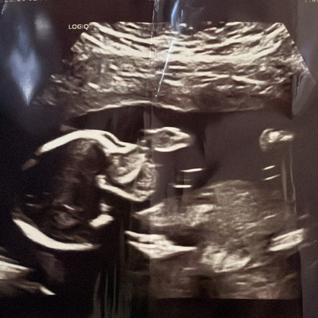 Photo shared by Aaron for their Babylist baby registry.