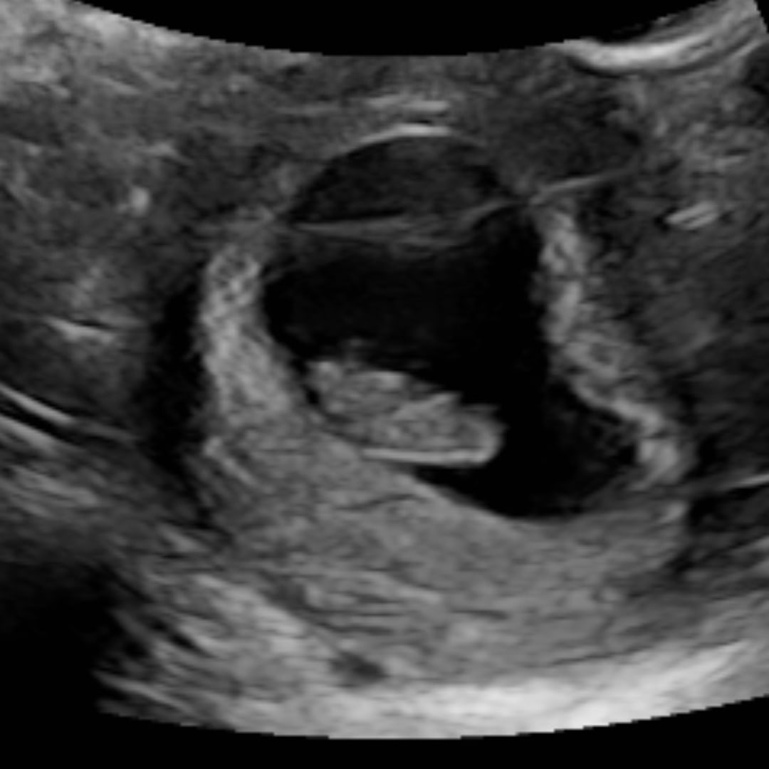 Photo shared by Kayla for their Babylist baby registry.