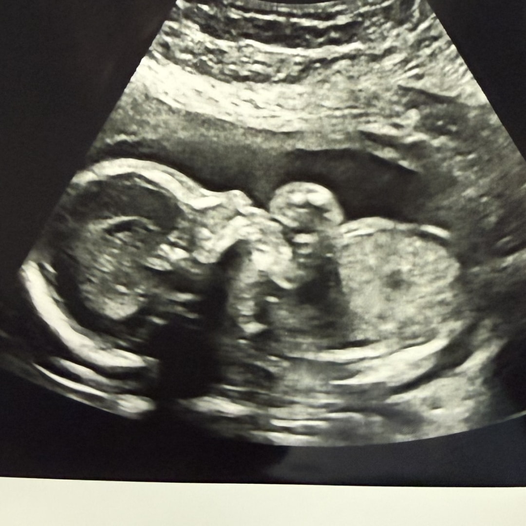Photo shared by Cristina for their Babylist baby registry.